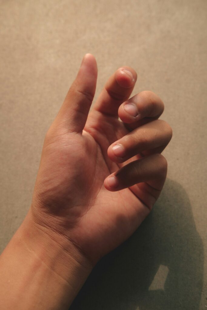 hands with very short nails
