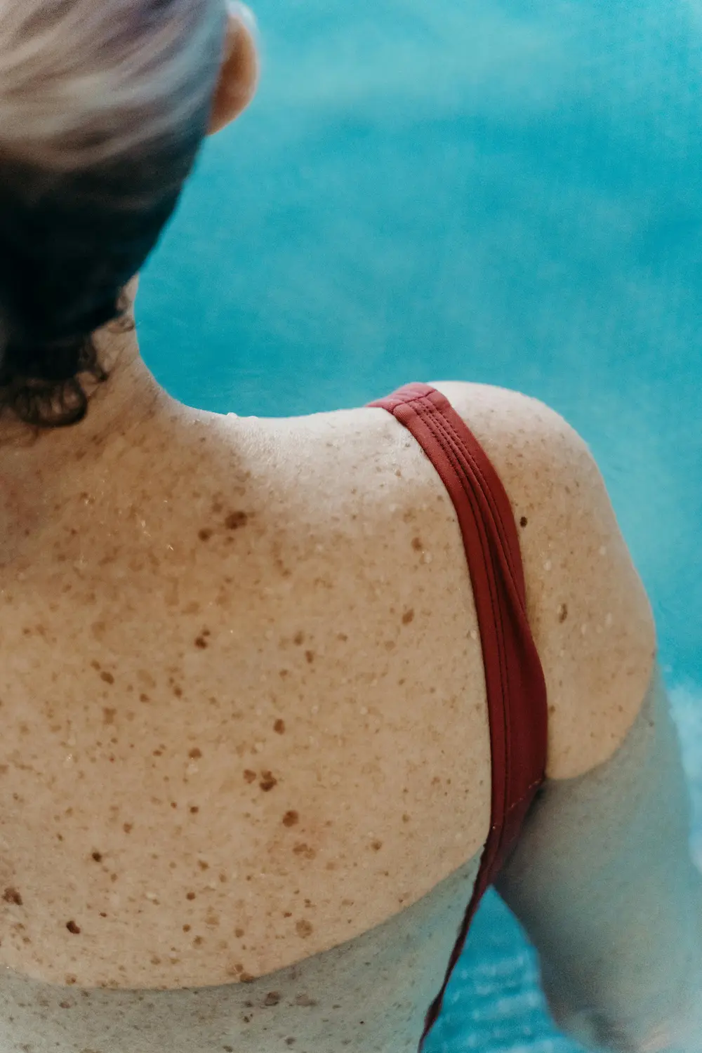 Skin damage from skipping sunscreen in skincare routine