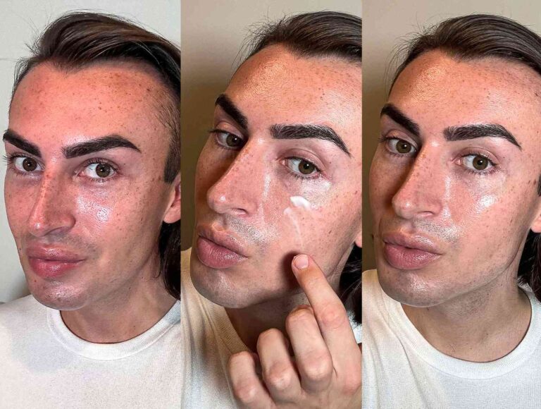 rosacea skin problem face
